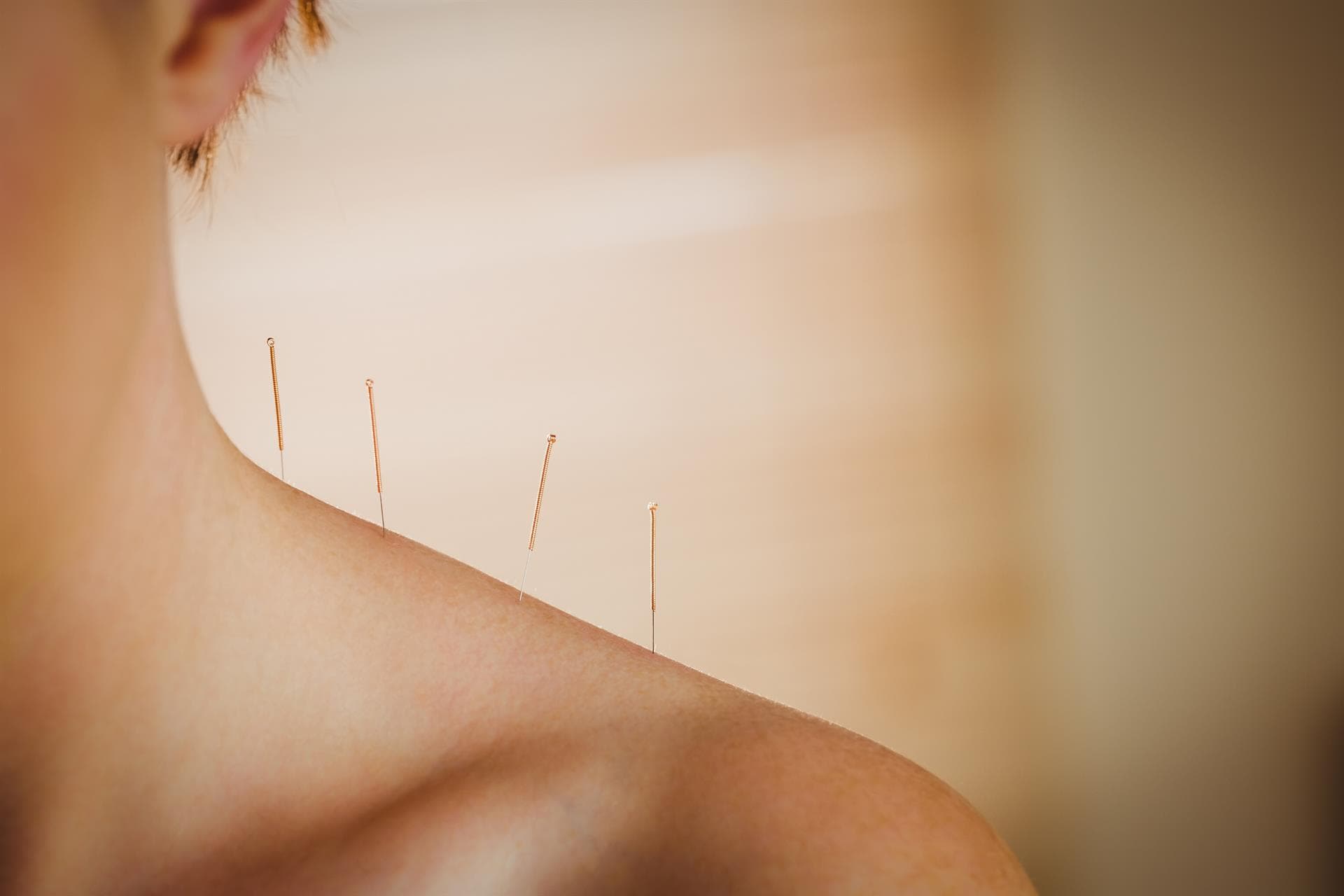 Tratamientos de acupuntura y digitopuntura